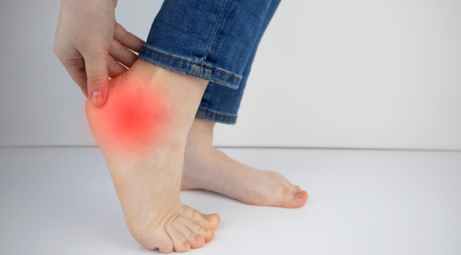Managing Plantar Fasciitis for a Pain-Free Holiday Season